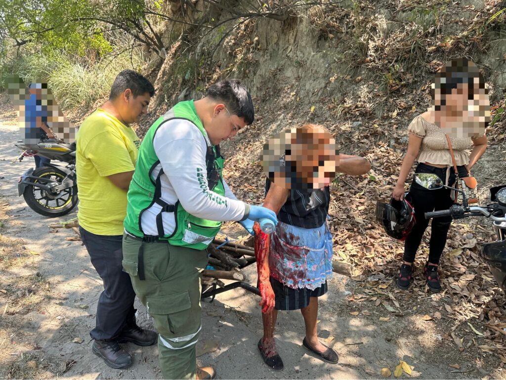 ADULTA MAYOR RESULTA ATROPELLADA EN CARRETERA DE ORO